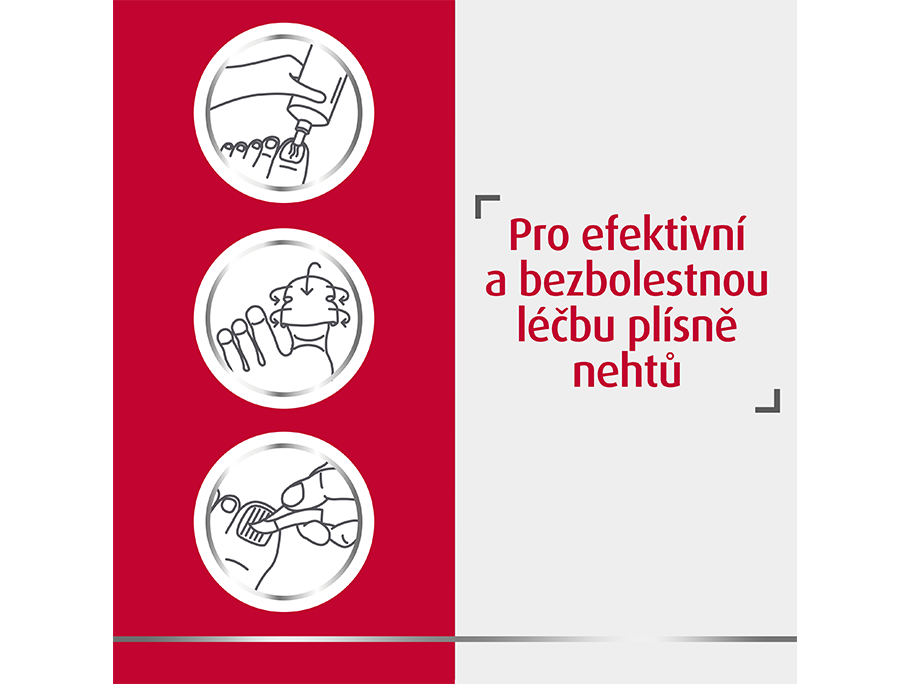 Pro efektivní a bezbolestnou léčbu